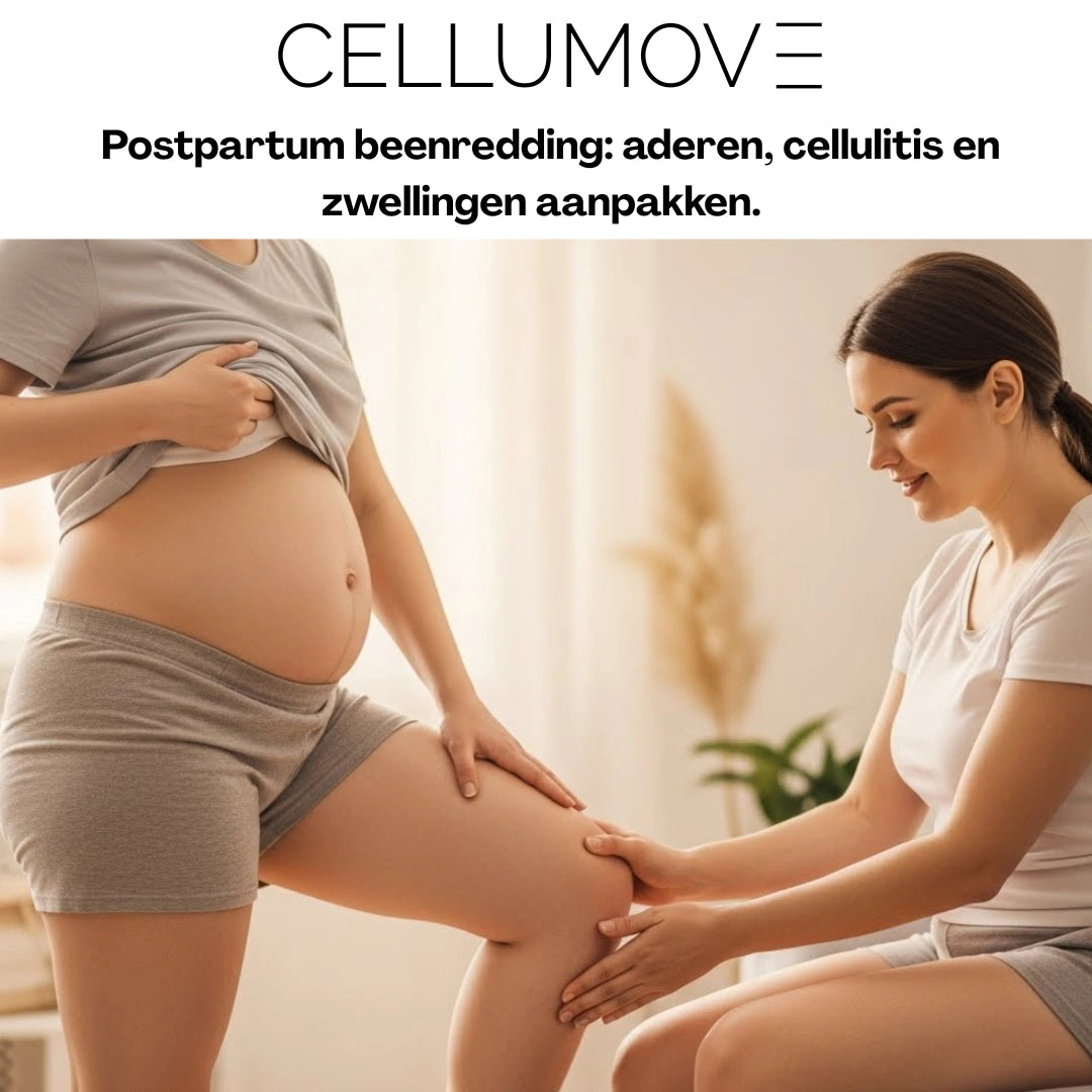 E-book: "Postpartum Leg Rescue: Tackling Veins, Cellulite, and Swelling."